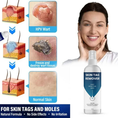 Skin Tag Remover 100 ml Pack of 2