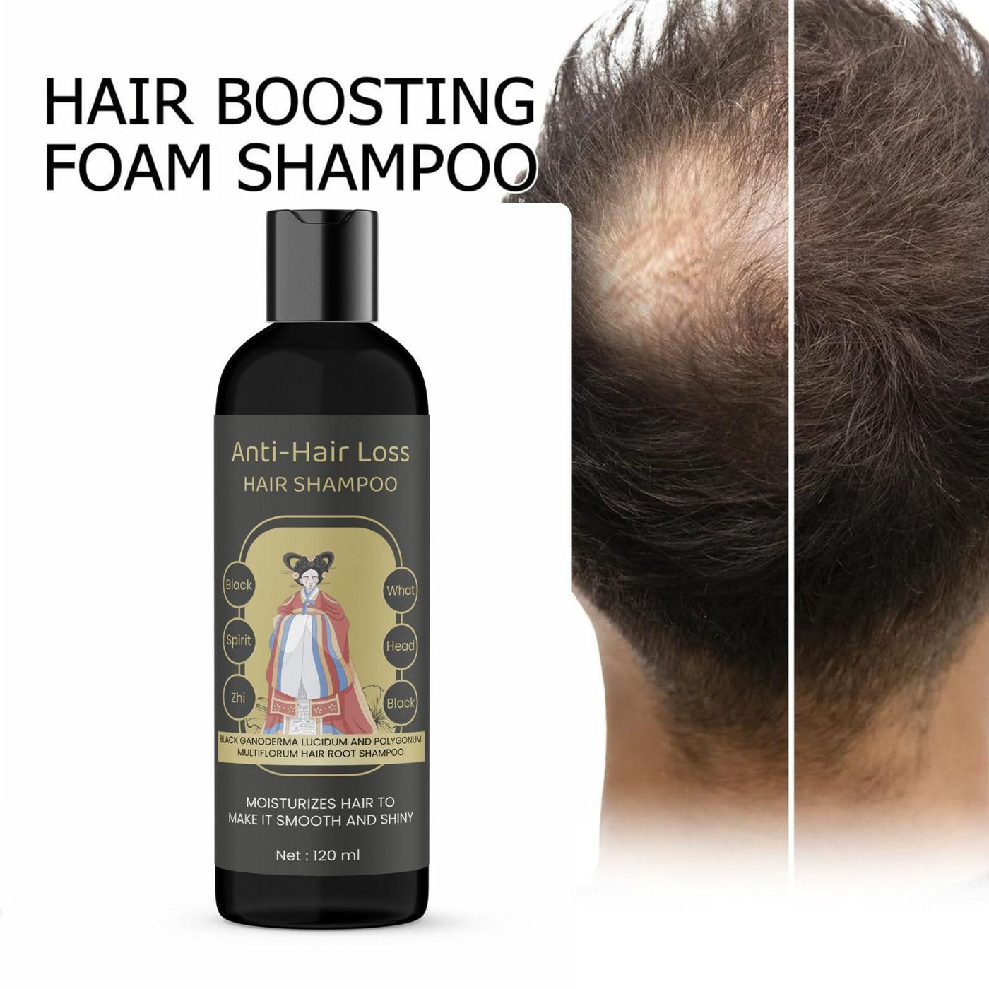 ANTI-HAIR LOSS HAIR SHAMPOO Black What Spirit